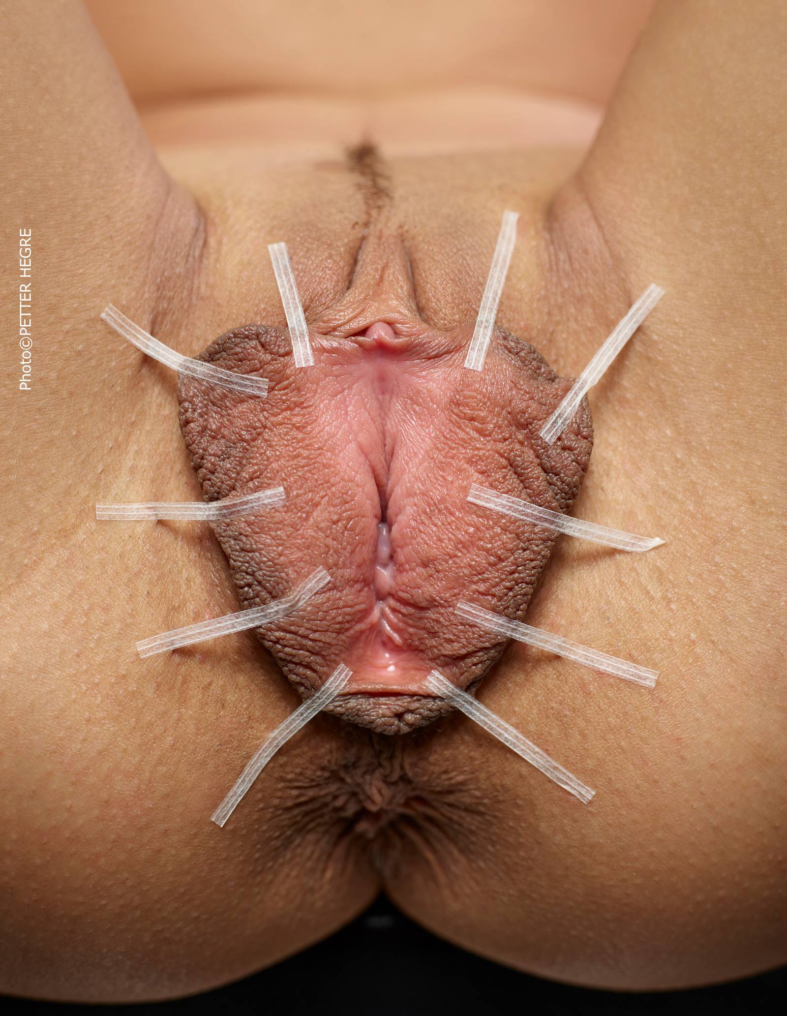 melanotan 2 reseller packs Buy MT-2 (Melanotan 2) | Order Research Peptides